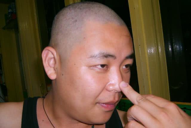 掌握拔罐技巧，享受健康生活，热门拔罐教学视频解析
